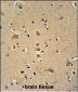 WIPF2 Antibody (C-term)