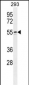WIPF2 Antibody (C-term)