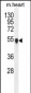 PPM1L Antibody  (C-term)