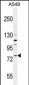 FZD6 Antibody (Center)