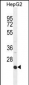 ICAM2 Antibody (Center)