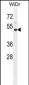 IL1R2 Antibody (Center)