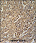 ENASE Antibody  (Center)