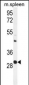 USF1 Antibody (Center)