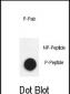 Phospho-Nephrin(Y1193)) Antibody