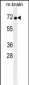 TNK1 Antibody