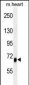 ACVR1B Antibody