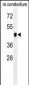 PDK2 Antibody