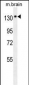 NTRK1 Antibody