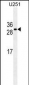 CDCA8 Antibody