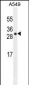 UBTD1 Antibody