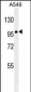 ZEB1 antibody ( Ascites)