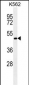 RNF8 antibody( Ascites)