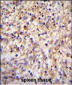 CLEC11A Antibody (Center)