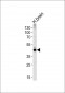 ALDOC Antibody (N-term)