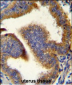 CCNB1 Antibody (C-term)