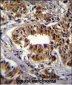 CAD Antibody (Center)