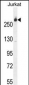 CAD Antibody (Center)