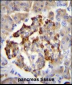 GAD2 Antibody (Center)
