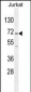 GAD2 Antibody (Center)