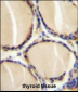 CALCA Antibody (Center)