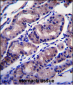 FOXA2 Antibody (Center)