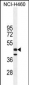 FGL2 Antibody (C-term)