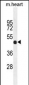 FGL2 Antibody (C-term)