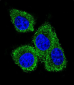 GCDFP-15 Antibody (C-term)