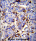 GCDFP-15 Antibody (C-term)