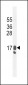 GCDFP-15 Antibody (C-term)