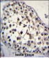 FUT8 Antibody (Center)