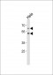 FUT8 Antibody (Center)