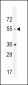 HTR2B Antibody (C-term E423)