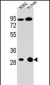 ETFA Antibody (C-term)