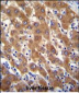 IRGM Antibody (C-term)