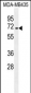 SFRS17A Antibody (Center)