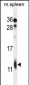 RPL39 Antibody (Center)
