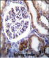 IFT88 Antibody (C-term)