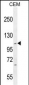 IFT88 Antibody (C-term)