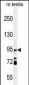 IFT88 Antibody (C-term)