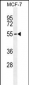 PMPCA Antibody (C-term)