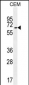UNCX Antibody (C-term)