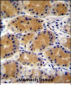 PLEKHG3 Antibody (C-term)