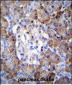 TIMP1 Antibody (C-term)