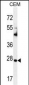 TIMP1 Antibody (C-term)