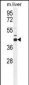 AHCY Antibody (N-term)