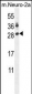 LIN28A Antibody (Center)