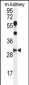 CCNG1 Antibody (C-term)