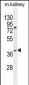 CCNH Antibody (N-term)